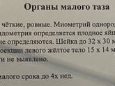 Помогите, реву! Что же это такое.