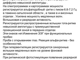 Делали ЭЭГ сегодня.