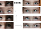 Паралич (парез) глазодвигательных мышц с *** атрофией зрительных нервов.