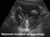 13,6Недель можно уже увидеть