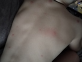 Девушки что это может быть? Хочу попасть к врачу конечно же