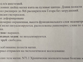 Гистероскопия.сделана.с выскабливанием
