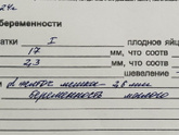 Здравствуйте, скажите нормальный результат узи?