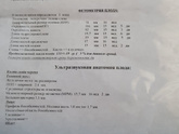 Ходила на узи,чтобы посмотреть пол. Срок 16+4
