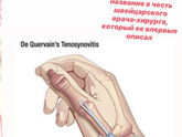 Болят запястья сбоку