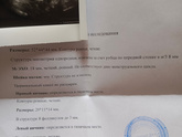 Планирование и толстый эндометрий
