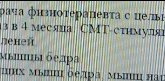 Остаточные явления дисплазии ТБС