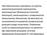 Мононуклеоз