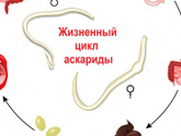 Глисты