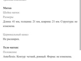 Удивительная беременность