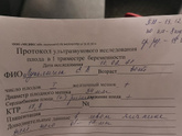 Узи.