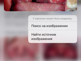Гной?? На миндалинах