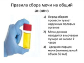 Сколько нужно мочи для анализа?