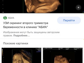 Узи
