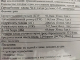 Узи 37-38 недель...
