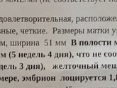 Узи 31 дпп