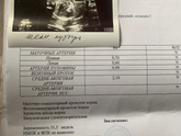 Что за *** ? не нашли желчный пузырь ?