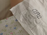 Тяжелые роды с конизацией ШМ