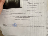Выкидыш