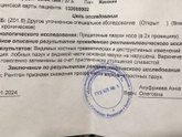 Гайморит или что