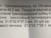 Стимуляция летрозол ... как было у Вас