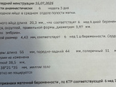 УЗИ динамика