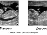 13,6Недель можно уже увидеть