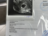 Повтор узи