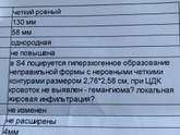 Узи печени.
