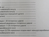 Ктг. Схватки.