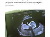 Первый скрининг....