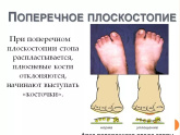Ну ё… все дело