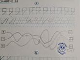Злость.