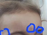 Что это может быть на лице у ребёнка.