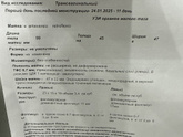 По делитесь методами залета