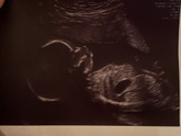 2 скрининг 💖🤰🏼