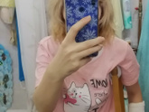 Племянница сломала руку.