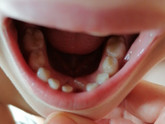Коренные зубы, ортодонт, фото