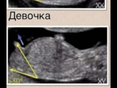 Всё ждём с мужем
