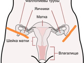 Колит место где трубы - яичники. Беременность 7 недель