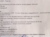 Узи