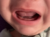 Первые зубы 🦷 ?!