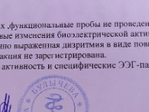 Сделали повторно ээг.