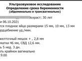 Первое УЗИ ,24дпп