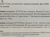 Фоликулометрия динамика