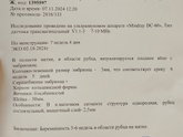 Чего ожидать?