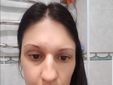 Отек от удаления зуба