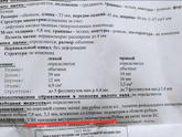 Узи (зайдите)
