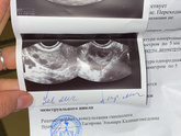 Мой организм явно сошёл с ума, как так то🤔😨
