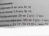 Невролгия.